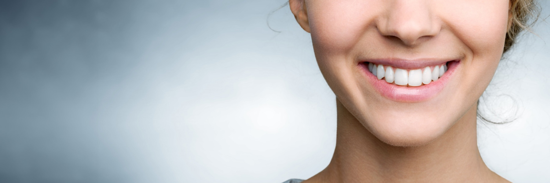 Smile Makeovers | Dentist