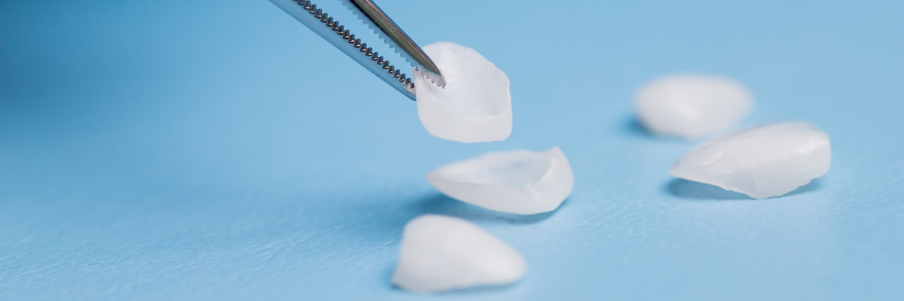Veneers | Dentist